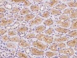 GALM Antibody, Novus Biologicals 50 &mu;g, Unconjugated:Antibodies, Polyclonal