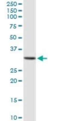 GALNT12 Antibody, Novus Biologicals 0.1 mg; Unconjugated:Antibodies, Polyclonal