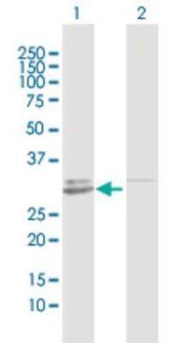 GALNT12 Antibody, Novus Biologicals 0.1 mg; Unconjugated:Antibodies, Polyclonal