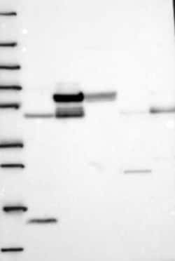 GALNTL1 Rabbit anti-Human, Polyclonal, Novus Biologicals 100 &mu;g | Buy Online | Novus Biologicals | Fisher Scientific
