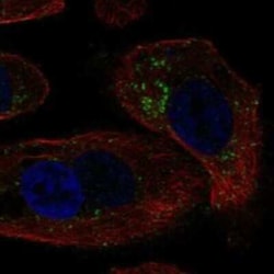 GALNTL4 Rabbit anti-Human, Polyclonal, Novus Biologicals:Antibodies:Primary