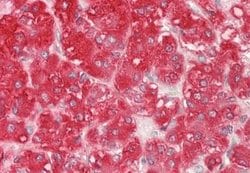 GALP Rabbit anti-Human, Polyclonal, Novus Biologicals 0.1 mL; Unconjugated:Antibodies,