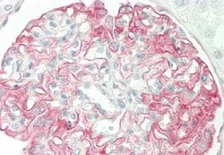 GALP Rabbit anti-Human, Polyclonal, Novus Biologicals 0.1 mL; Unconjugated:Antibodies,