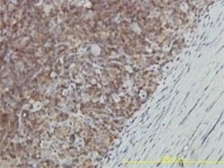 GALT Antibody (4C11), Novus Biologicals 0.1 mg | Buy Online | Novus Biologicals | Fisher Scientific