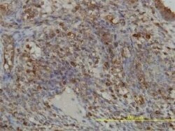 GART Antibody (4D6-1D5), Novus Biologicals 0.1 mg | Buy Online | Novus Biologicals | Fisher Scientific