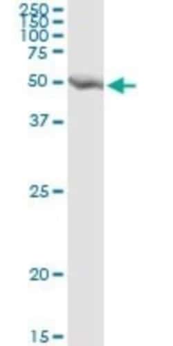 GART Antibody (4D6-1D5), Novus Biologicals 0.1 mg | Buy Online | Novus Biologicals | Fisher Scientific