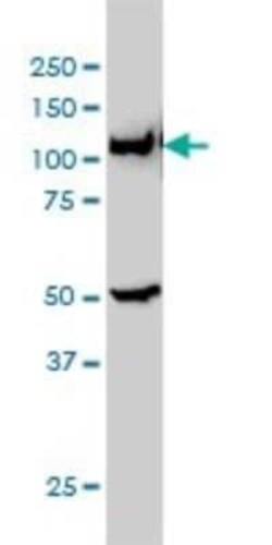 GART Antibody (4D6-1D5), Novus Biologicals 0.1 mg | Buy Online | Novus Biologicals | Fisher Scientific