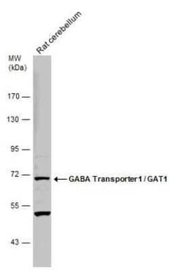 GAT-1/SLC6A1 Antibody, Novus Biologicals 100 &mu;g | Buy Online | Novus Biologicals | Fisher Scientific