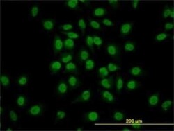 GATA-2 Antibody (1A5), Novus Biologicals 0.05 mg | Buy Online | Novus Biologicals | Fisher Scientific