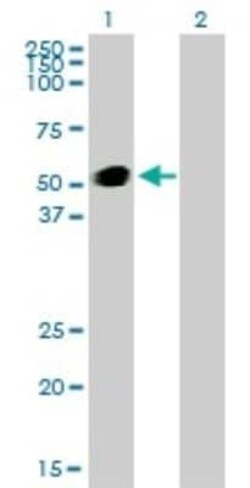 GATA-2 Antibody (2D11), Novus Biologicals 0.1 mg, Unconjugated:Antibodies,