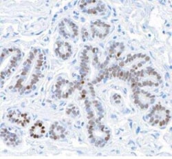 GATA-3 Antibody (BLR121H), Novus Biologicals 100 &mu;g | Buy Online | Novus Biologicals | Fisher Scientific