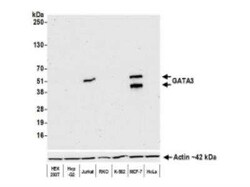 GATA-3 Antibody (BLR121H), Novus Biologicals 100 &mu;g | Buy Online | Novus Biologicals | Fisher Scientific