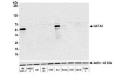 GATA-3 Antibody (BLR121H), Novus Biologicals 100 &mu;g | Buy Online | Novus Biologicals | Fisher Scientific