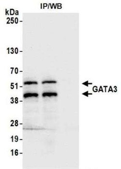 GATA-3 Antibody (BLR121H), Novus Biologicals 100 &mu;g | Buy Online | Novus Biologicals | Fisher Scientific