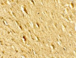 GATE-16/GABARAPL2 Antibody - BSA Free, Novus Biologicals 0.1 mg; Unconjugated:Antibodies,