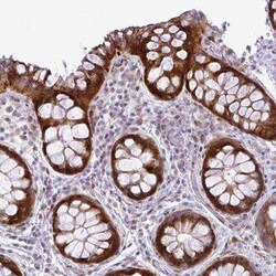 GATSL2 Antibody, Novus Biologicals:Antibodies:Primary Antibodies