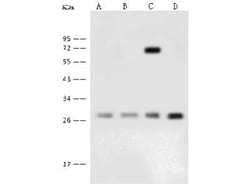 GBAS Antibody, Novus Biologicals 50 &mu;g; Unconjugated:Antibodies, Polyclonal