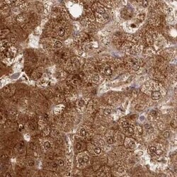 GBE1 Antibody, Novus Biologicals 0.1 mL; Unconjugated:Antibodies, Polyclonal