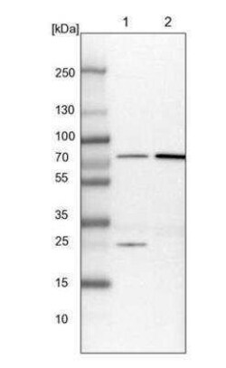 GBE1 Antibody, Novus Biologicals 0.1 mL; Unconjugated:Antibodies, Polyclonal