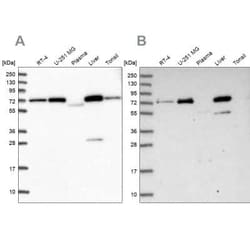 GBE1 Antibody, Novus Biologicals 0.1 mL; Unconjugated:Antibodies, Polyclonal