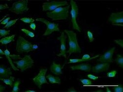 GBF1 Antibody (4B2), Novus Biologicals 0.1 mg | Buy Online | Novus Biologicals | Fisher Scientific