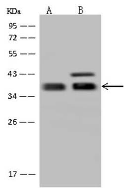 GBL Antibody, Novus Biologicals:Antibodies:Primary Antibodies