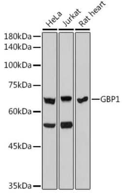 GBP1 Rabbit anti-Human, Rat, Clone: 3X7O9, Novus Biologicals 20 &mu;g;
