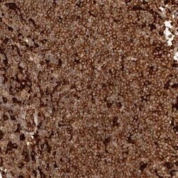 GBP5 Antibody, Novus Biologicals 25 &mu;L | Buy Online | Novus Biologicals | Fisher Scientific