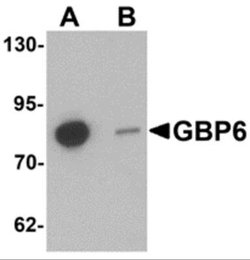 GBP6 Antibody - BSA Free, Novus Biologicals 0.1 mg | Buy Online | Novus Biologicals | Fisher Scientific