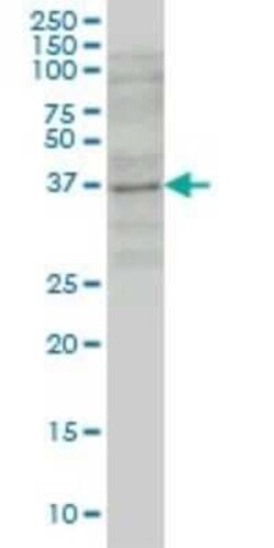 GBX2 Antibody (1A7), Novus Biologicals 0.1 mg | Buy Online | Novus Biologicals | Fisher Scientific