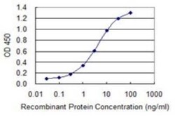 GCAP2 Antibody (5E7), Novus Biologicals 0.1 mg | Buy Online | Novus Biologicals | Fisher Scientific