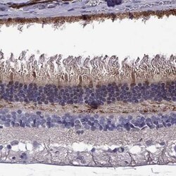 GCAP2 Antibody, Novus Biologicals 100 &mu;g; Unconjugated:Antibodies, Polyclonal