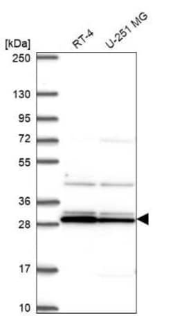GCAP2 Antibody, Novus Biologicals 100 &mu;g; Unconjugated:Antibodies, Polyclonal