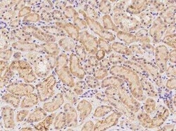 GCAT Antibody, Novus Biologicals:Antibodies:Primary Antibodies
