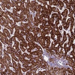 GCDH Antibody, Novus Biologicals 0.1 mL, Unconjugated:Antibodies, Polyclonal