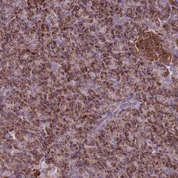 GCDH Antibody, Novus Biologicals 0.1 mL, Unconjugated:Antibodies, Polyclonal