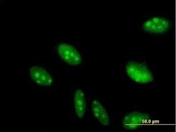 GCFC2 Antibody, Novus Biologicals 0.05 mg | Buy Online | Novus Biologicals | Fisher Scientific