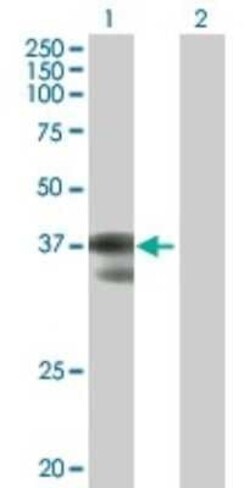 GCFC2 Antibody, Novus Biologicals 0.05 mg | Buy Online | Novus Biologicals | Fisher Scientific