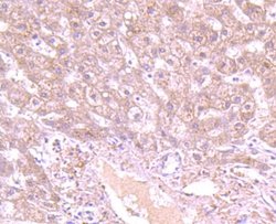 GCLC Rabbit anti-Human, Clone: JA08-03, Novus Biologicals 100&mu;L:Antibodies,