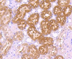 GCLC Rabbit anti-Human, Clone: JA08-03, Novus Biologicals 100&mu;L:Antibodies,