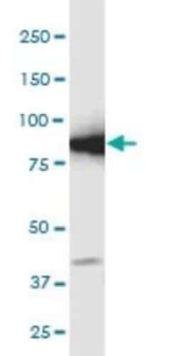 GCLC Antibody (3H1), Novus Biologicals 0.1 mg | Buy Online | Novus Biologicals | Fisher Scientific