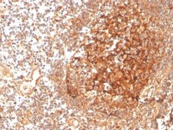 GCLM Antibody (CPTC-GCLM-1) - Azide and BSA Free, Novus Biologicals 100