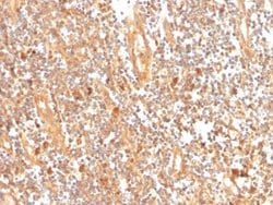 GCLM Antibody (CPTC-GCLM-1) - Azide and BSA Free, Novus Biologicals 100