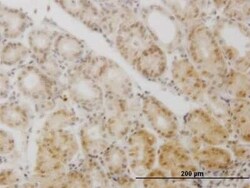 GCM1 Antibody (2E11), Novus Biologicals 0.1 mg | Buy Online | Novus Biologicals | Fisher Scientific