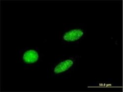 GCM1 Antibody (4C11), Novus Biologicals 0.1 mg | Buy Online | Novus Biologicals | Fisher Scientific