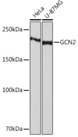 GCN2 Rabbit anti-Human, Clone: 6E2X0, Novus Biologicals 20 &mu;g | Buy Online | Novus Biologicals | Fisher Scientific