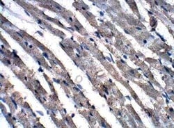 GCN2 Antibody, Novus Biologicals 100 &mu;g | Buy Online | Novus Biologicals | Fisher Scientific
