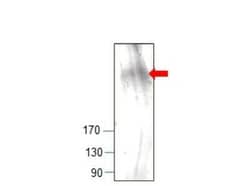 GCN2 Antibody, Novus Biologicals 100 &mu;g | Buy Online | Novus Biologicals | Fisher Scientific