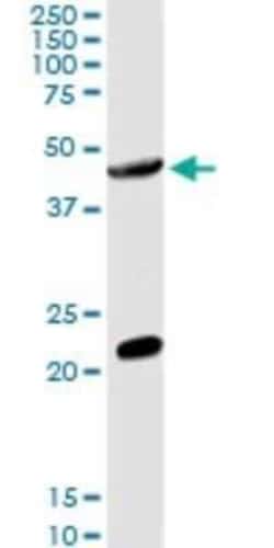 GCNT2 Antibody, Novus Biologicals 0.1 mg, Unconjugated:Antibodies, Polyclonal