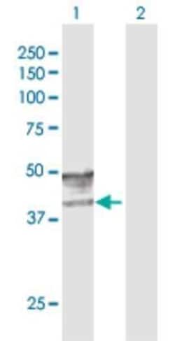 GCNT2 Antibody, Novus Biologicals 0.1 mg, Unconjugated:Antibodies, Polyclonal